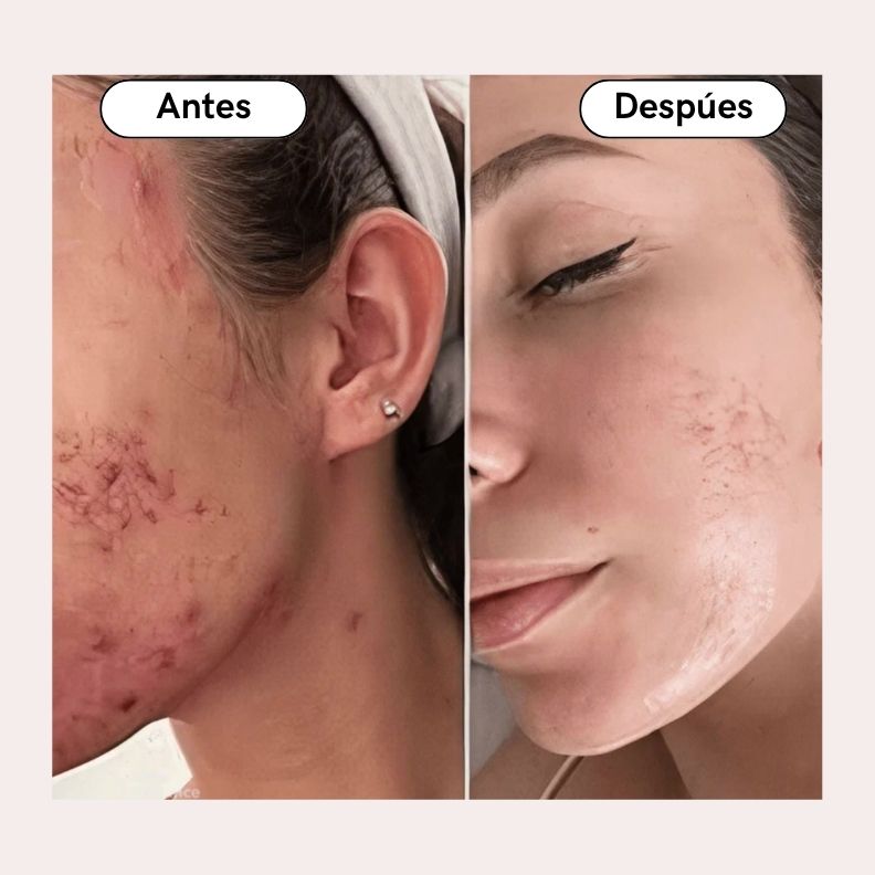 Mascara Facial Aura ™