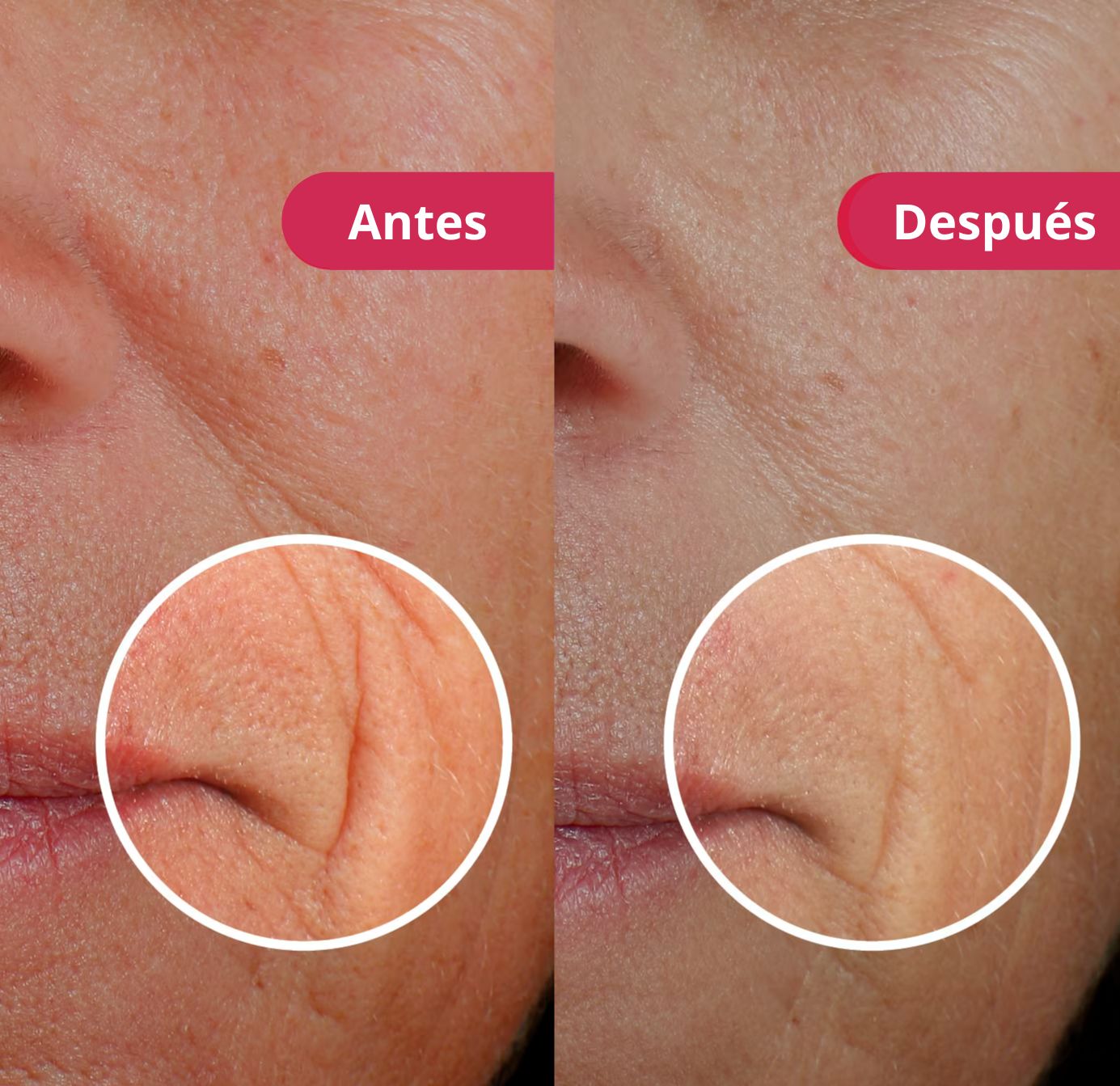 Mascara Facial Aura ™