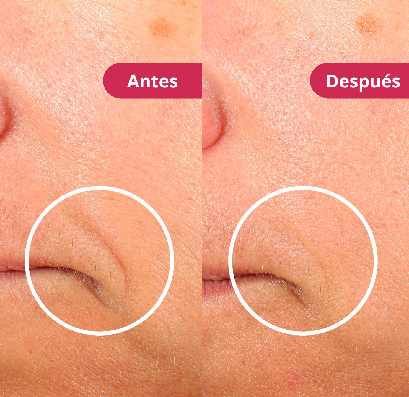 Mascara Facial Aura ™