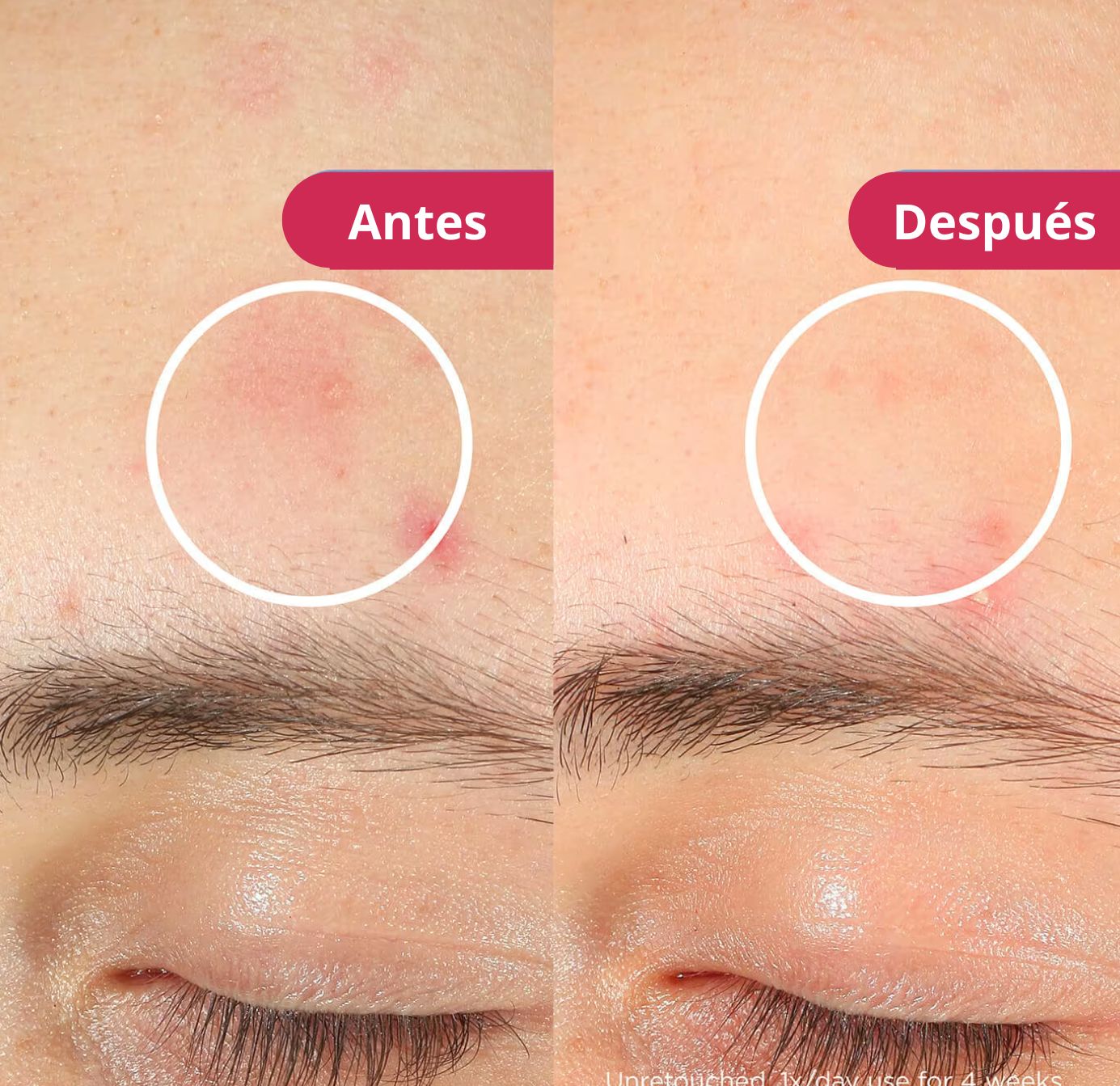 Mascara Facial Aura ™